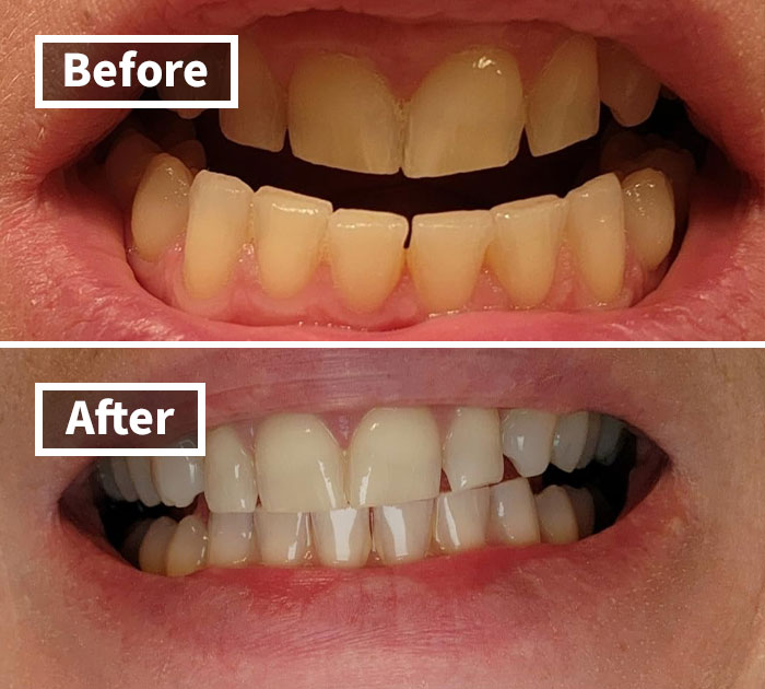 24 Mortifying Body Problems Nobody Wants To Talk About But Everyone Has 24 Mortifying Body Problems Nobody Wants To Talk About But Everyone Has