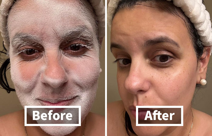 24 Mortifying Body Problems Nobody Wants To Talk About But Everyone Has 24 Mortifying Body Problems Nobody Wants To Talk About But Everyone Has