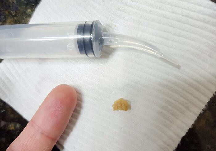 24 Mortifying Body Problems Nobody Wants To Talk About But Everyone Has 24 Mortifying Body Problems Nobody Wants To Talk About But Everyone Has