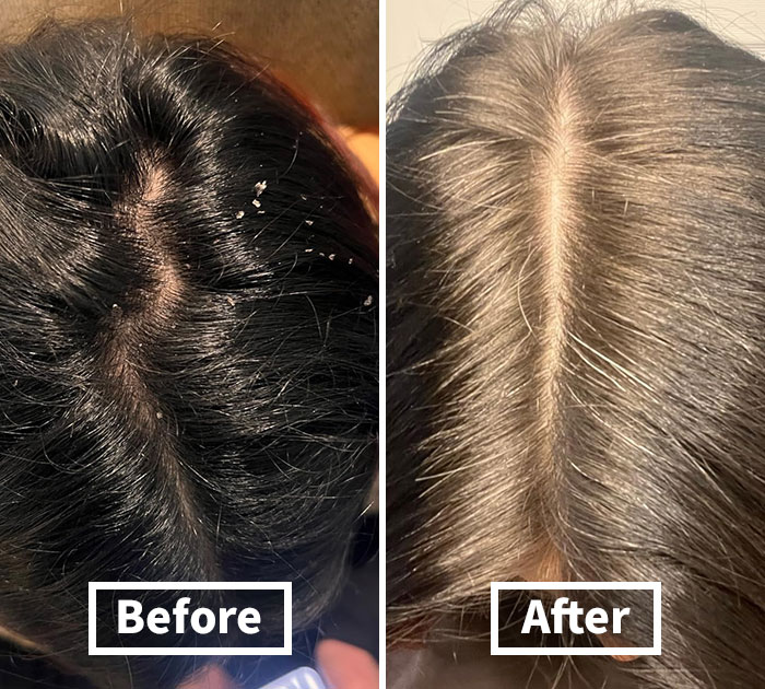 24 Mortifying Body Problems Nobody Wants To Talk About But Everyone Has 24 Mortifying Body Problems Nobody Wants To Talk About But Everyone Has