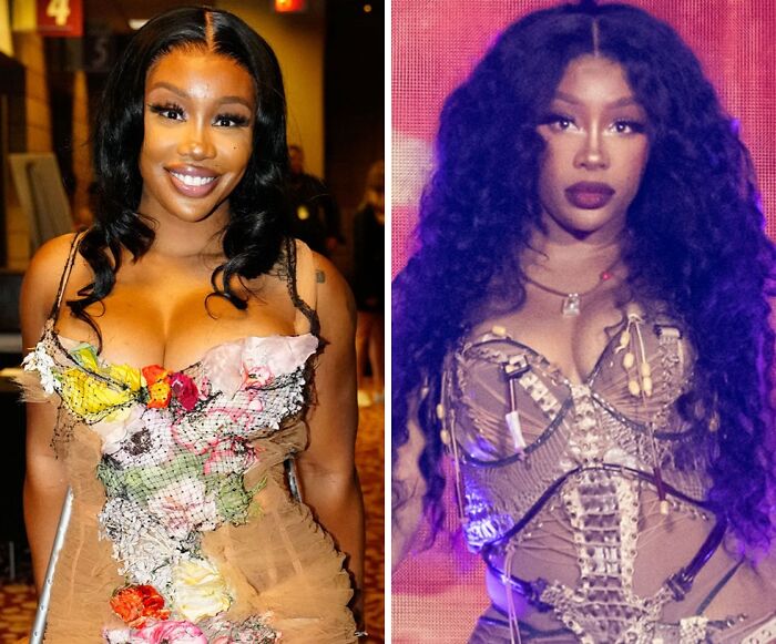 These 20 Celebs Had Their Breast Implants Removed—Before And After Photos Revealed These 20 Celebs Had Their Breast Implants Removed—Before And After Photos Revealed