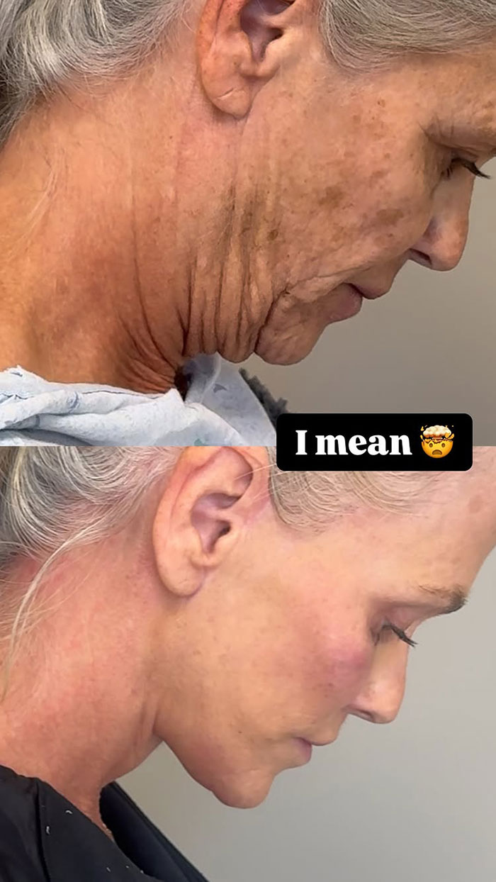 “Phenomenal Results”: 66-Year-Old Woman Undergoes 9 Surgeries In 6 Hours, Breaks The Internet “Phenomenal Results”: 66-Year-Old Woman Undergoes 9 Surgeries In 6 Hours, Breaks The Internet
