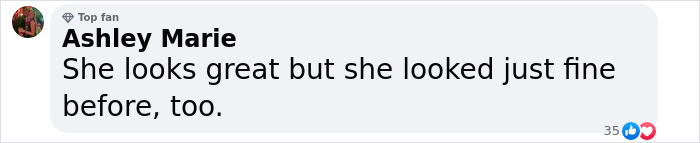 “Phenomenal Results”: 66-Year-Old Woman Undergoes 9 Surgeries In 6 Hours, Breaks The Internet “Phenomenal Results”: 66-Year-Old Woman Undergoes 9 Surgeries In 6 Hours, Breaks The Internet