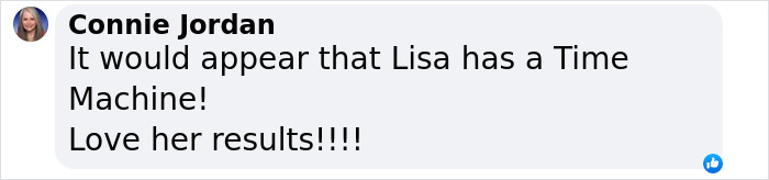 “Phenomenal Results”: 66-Year-Old Woman Undergoes 9 Surgeries In 6 Hours, Breaks The Internet “Phenomenal Results”: 66-Year-Old Woman Undergoes 9 Surgeries In 6 Hours, Breaks The Internet