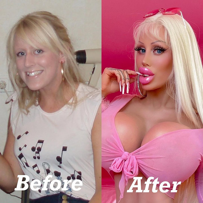 “So Sad”: Woman Who Spent Over $120k To Become Barbie Reveals What She Looked Like Before “So Sad”: Woman Who Spent Over $120k To Become Barbie Reveals What She Looked Like Before