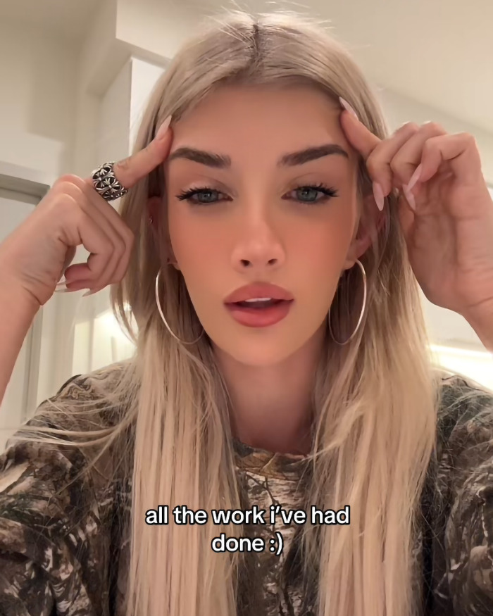 “Wish I Went Bigger”: Denise Richards’ Daughter Sami Sheen Reveals All Her Cosmetic Surgeries “Wish I Went Bigger”: Denise Richards’ Daughter Sami Sheen Reveals All Her Cosmetic Surgeries