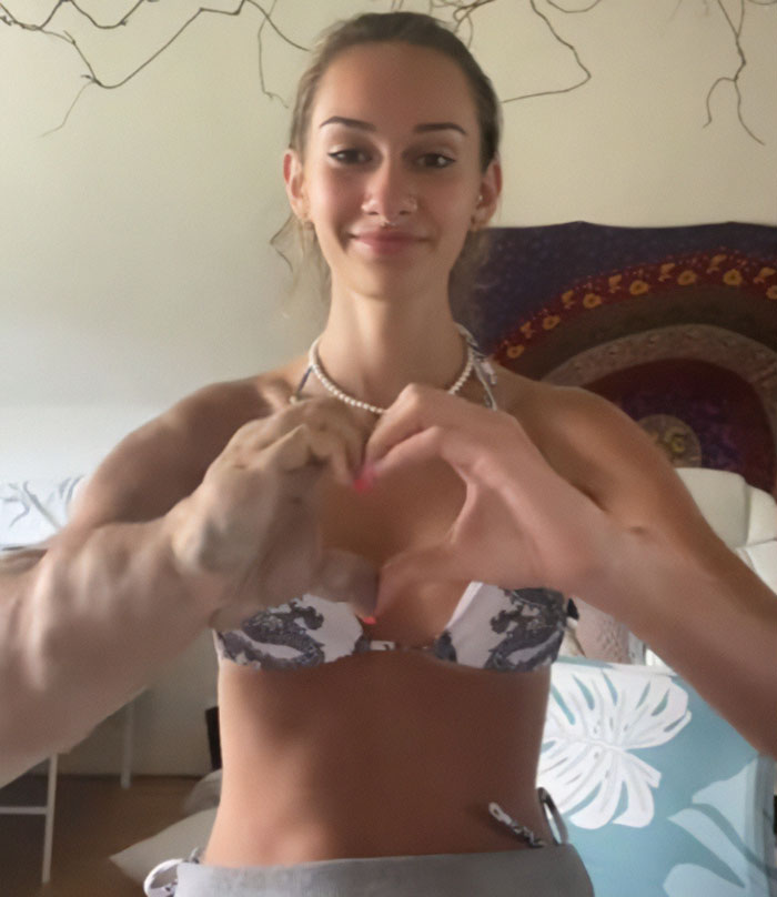 “I Always Explain”: Woman With One Arm Larger Than The Other Reveals Her Response To Stares “I Always Explain”: Woman With One Arm Larger Than The Other Reveals Her Response To Stares