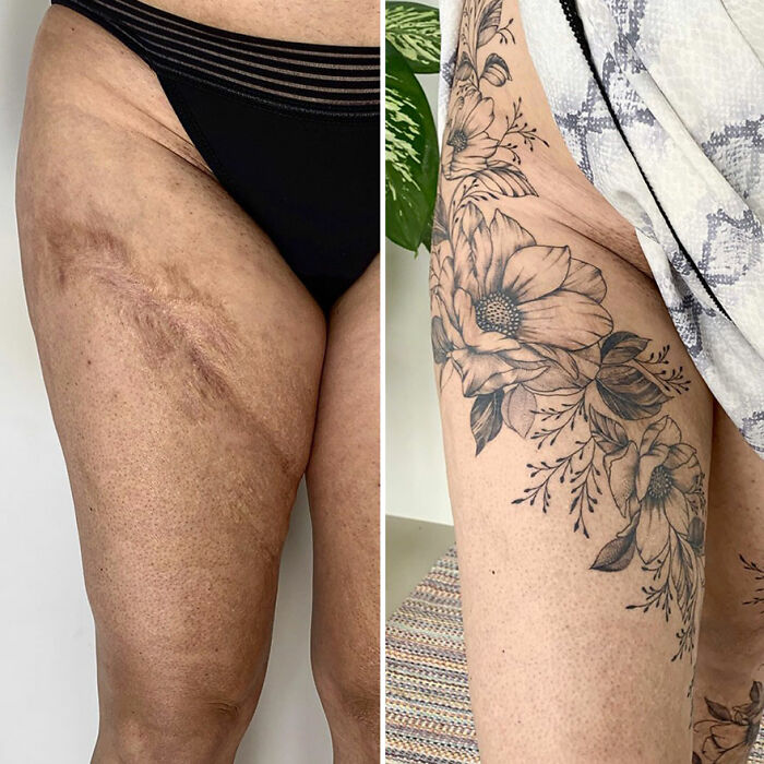 Tattoo Artist Covers Scars With Delicate Designs, And Here Are Her 30 Best Transformations Tattoo Artist Covers Scars With Delicate Designs, And Here Are Her 30 Best Transformations