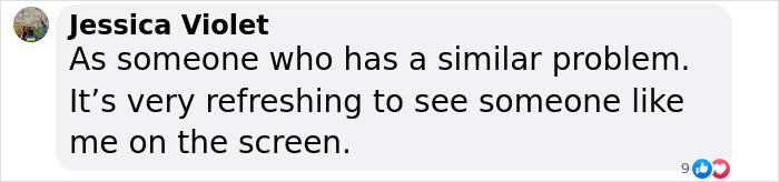 “Looks Ridiculous”: After People Incessantly Criticize Her Appearance, Actress Responds