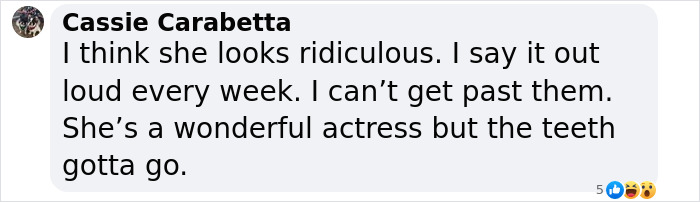 “Looks Ridiculous”: After People Incessantly Criticize Her Appearance, Actress Responds