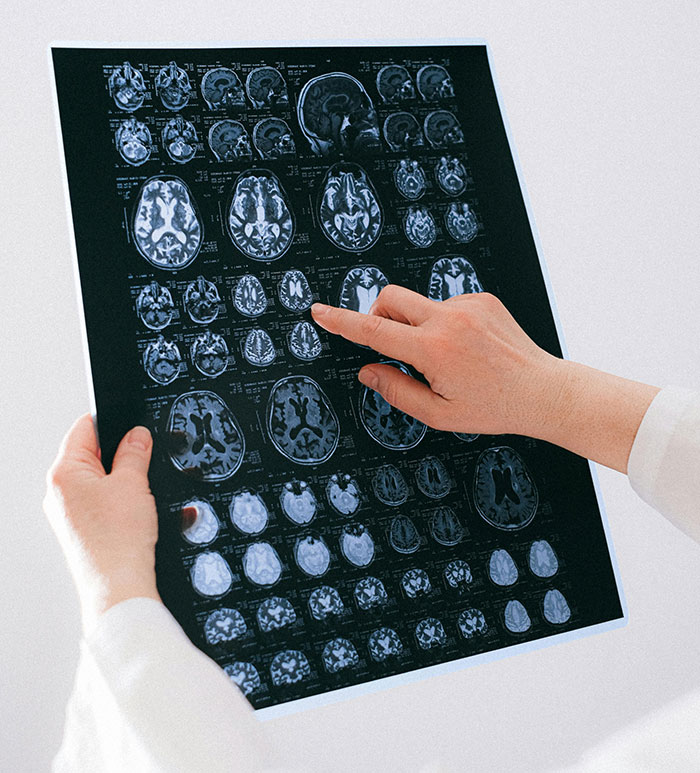 30 Doctors Reveal The Most Baffling Things About The Human Body They Have No Answers For 30 Doctors Reveal The Most Baffling Things About The Human Body They Have No Answers For