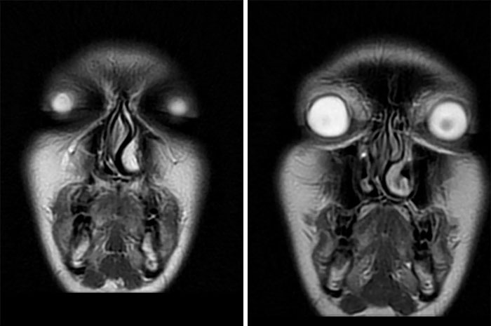 “Oddly Terrifying”: 50 Of The Most Unnerving Images That Feel Like A Glitch In Reality (New Pics) “Oddly Terrifying”: 50 Of The Most Unnerving Images That Feel Like A Glitch In Reality (New Pics)