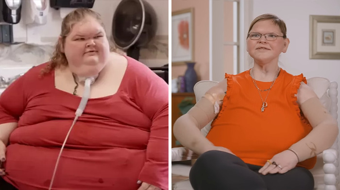 Stunning Transformation Of ‘1000-lb Sisters’ Star Goes Viral As She Reveals ‘Terrifying’ 8-Hour Surgery Stunning Transformation Of ‘1000-lb Sisters’ Star Goes Viral As She Reveals ‘Terrifying’ 8-Hour Surgery