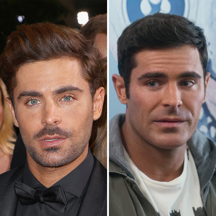 Zac Efron’s ‘Back to Normal’ Face Has Everyone Talking As Expert Weighs In On What Happened Zac Efron’s ‘Back to Normal’ Face Has Everyone Talking As Expert Weighs In On What Happened