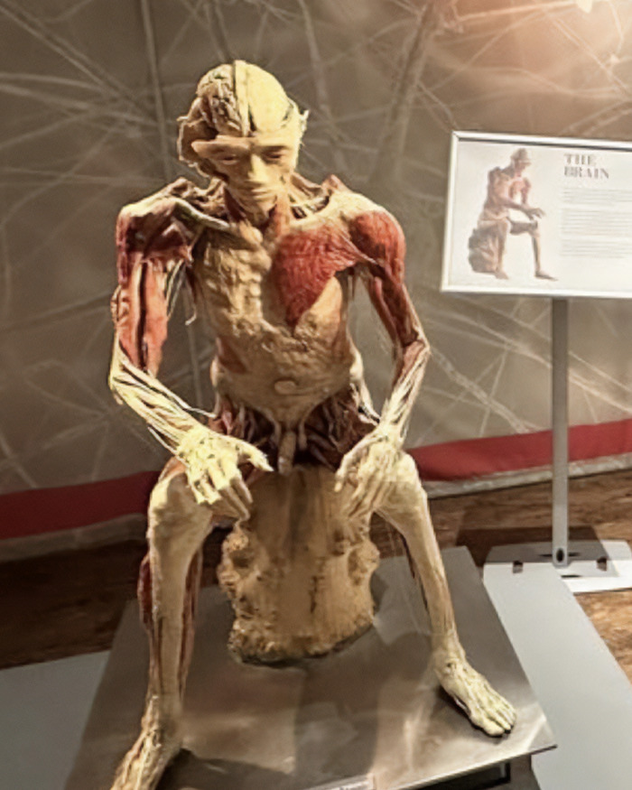 Mom’s Stunning Claim That Skinned Body In Las Vegas Museum Is Her Son Divides The Internet Mom’s Stunning Claim That Skinned Body In Las Vegas Museum Is Her Son Divides The Internet
