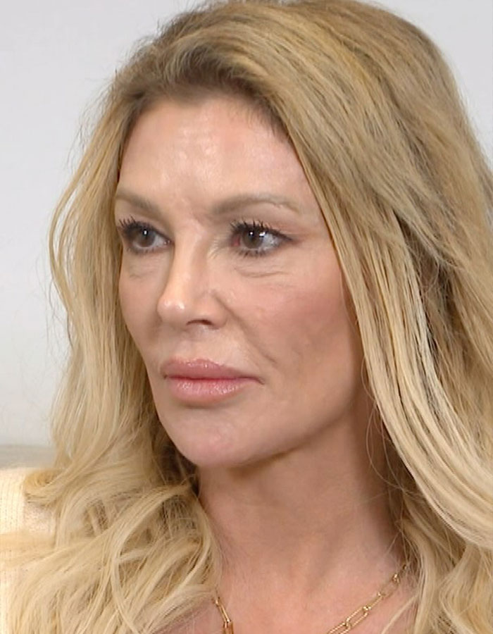 Brandi Glanville Finally Receives Diagnosis For Facial Disfigurement After Blaming A Parasite Brandi Glanville Finally Receives Diagnosis For Facial Disfigurement After Blaming A Parasite