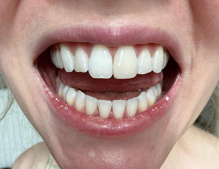 “You Will Pay For It Later”: 49 Common Habits That Might Be Wrecking Your Health Long-Term “You Will Pay For It Later”: 49 Common Habits That Might Be Wrecking Your Health Long-Term