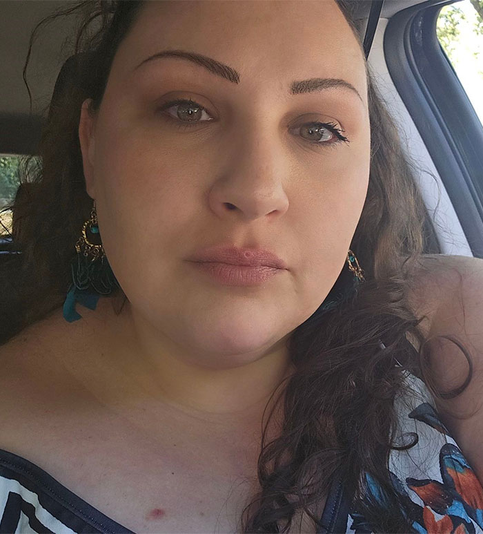 “Revenge For Getting Their Feelings Hurt”: Cops Reveal What Led Teen Boys To Set 14YO Girl On Fire “Revenge For Getting Their Feelings Hurt”: Cops Reveal What Led Teen Boys To Set 14YO Girl On Fire