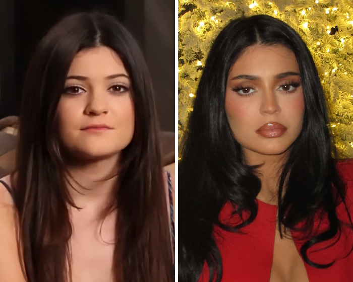 Mom, 31, On Life Support After Traveling To Vietnam For Plastic Surgery Mom, 31, On Life Support After Traveling To Vietnam For Plastic Surgery