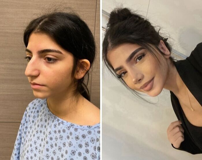 67 People Who Became Completely Unrecognizable After Getting Cosmetic Surgery In Turkey 67 People Who Became Completely Unrecognizable After Getting Cosmetic Surgery In Turkey