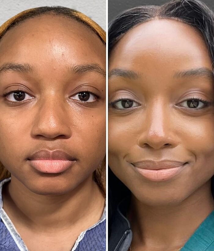 67 People Who Became Completely Unrecognizable After Getting Cosmetic Surgery In Turkey 67 People Who Became Completely Unrecognizable After Getting Cosmetic Surgery In Turkey