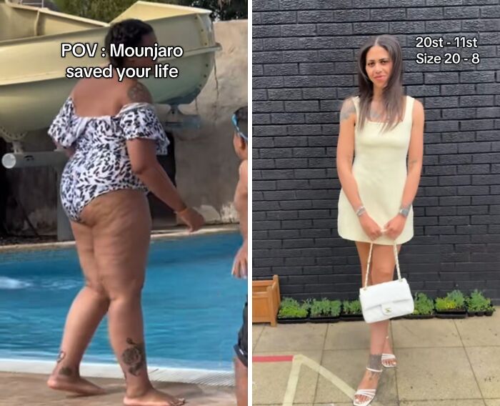 &#8220;The Mounjaro Effect&#8221;: 40 Mounjaro Users Share Their Weight Loss Journeys