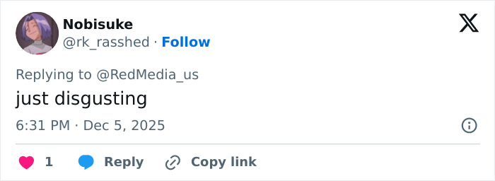 “So Gross”: Cardi B Slammed After Getting New Set Of Neck And Back Piercings