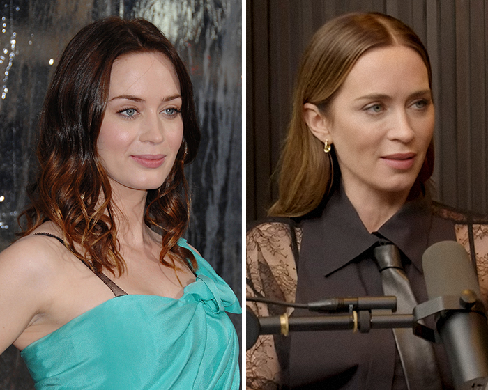 “Surgeon Needs To Be Arrested”: Emily Blunt’s Podcast Appearance Sparks Plastic Surgery Rumors “Surgeon Needs To Be Arrested”: Emily Blunt’s Podcast Appearance Sparks Plastic Surgery Rumors