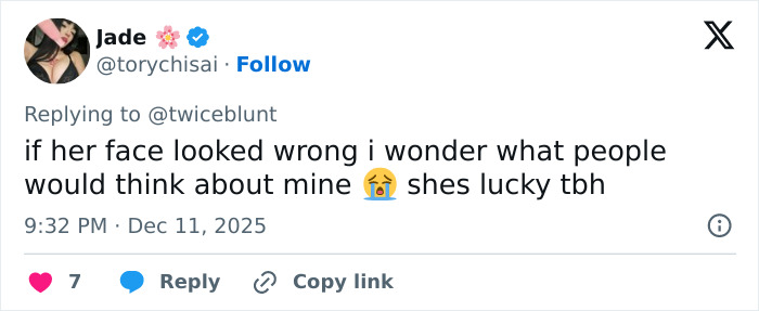 “Surgeon Needs To Be Arrested”: Emily Blunt’s Podcast Appearance Sparks Plastic Surgery Rumors “Surgeon Needs To Be Arrested”: Emily Blunt’s Podcast Appearance Sparks Plastic Surgery Rumors