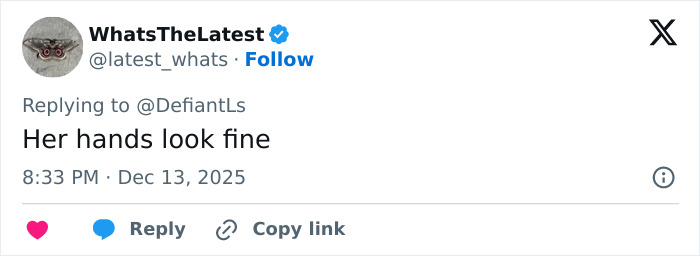 “Makes Herself Look Like A Demon”: Cynthia Erivo’s “Oddly Large Hands” Spark Debate “Makes Herself Look Like A Demon”: Cynthia Erivo’s “Oddly Large Hands” Spark Debate