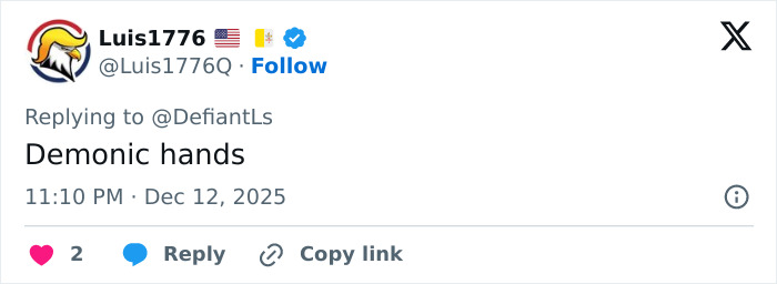 “Makes Herself Look Like A Demon”: Cynthia Erivo’s “Oddly Large Hands” Spark Debate “Makes Herself Look Like A Demon”: Cynthia Erivo’s “Oddly Large Hands” Spark Debate