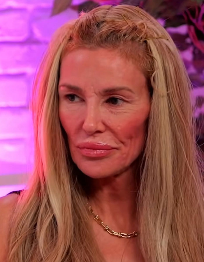 “Psychosis On Display”: Brandi Glanville Goes Bold In Red Bikini After Face Disfigurement Diagnosis “Psychosis On Display”: Brandi Glanville Goes Bold In Red Bikini After Face Disfigurement Diagnosis