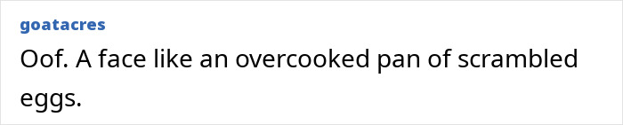 “Psychosis On Display”: Brandi Glanville Goes Bold In Red Bikini After Face Disfigurement Diagnosis “Psychosis On Display”: Brandi Glanville Goes Bold In Red Bikini After Face Disfigurement Diagnosis