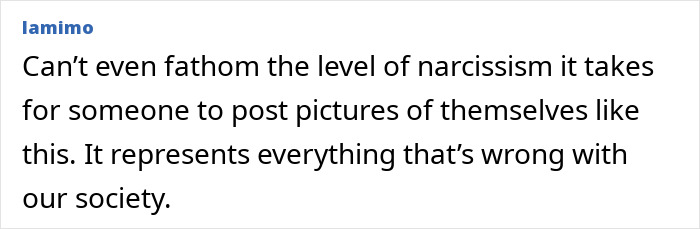 “Psychosis On Display”: Brandi Glanville Goes Bold In Red Bikini After Face Disfigurement Diagnosis “Psychosis On Display”: Brandi Glanville Goes Bold In Red Bikini After Face Disfigurement Diagnosis