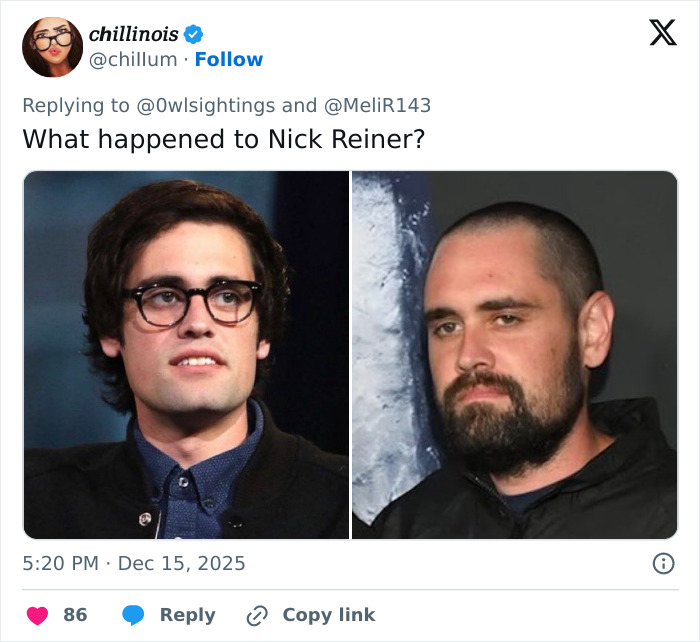 &ldquo;This Is Seriously Distasteful&rdquo;: Trump Under Fire For Post Claiming Rob Reiner And Wife Passed From &lsquo;TDS&rsquo;