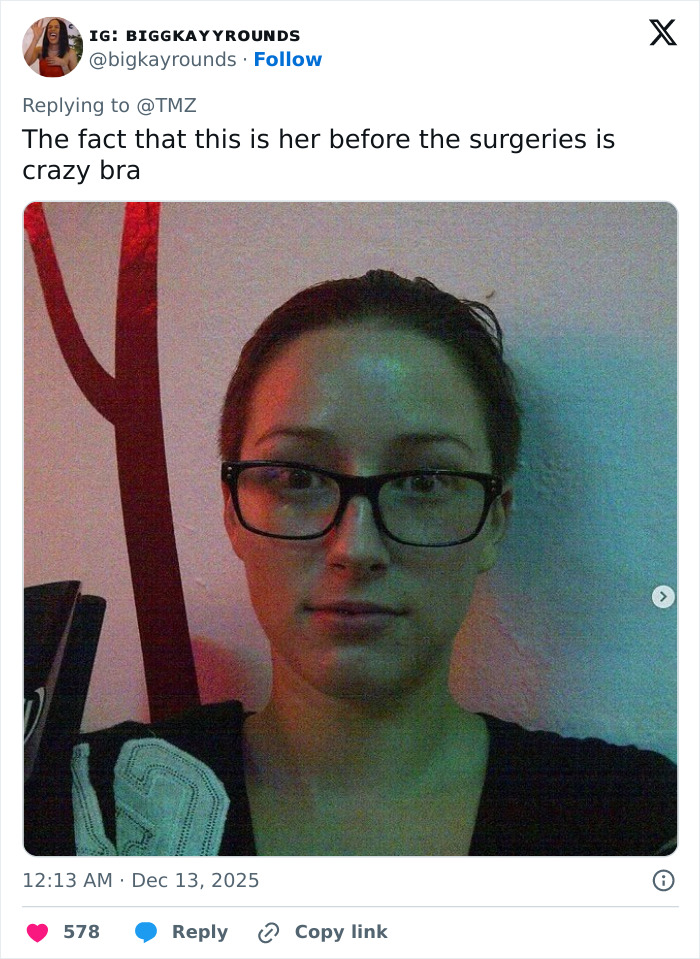 “She Was Not Well”: Mary Magdalene, 33, Influencer Known For Extreme Cosmetic Surgeries, Passes Away After High‑Rise Fall