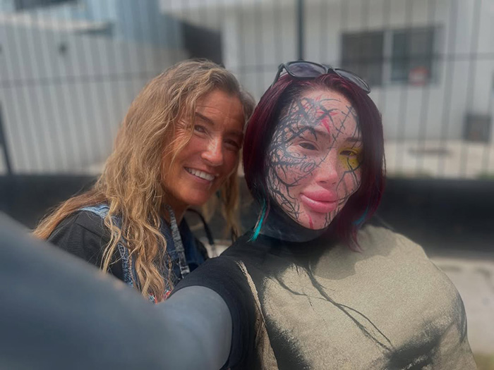 “She Was Not Well”: Mary Magdalene, 33, Influencer Known For Extreme Cosmetic Surgeries, Passes Away After High‑Rise Fall