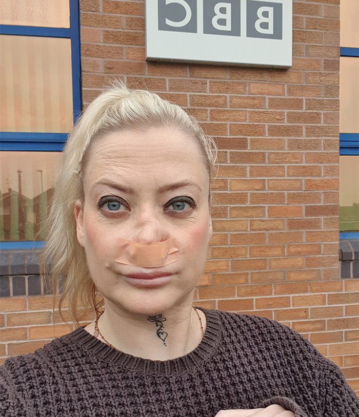 &ldquo;My Face Is Changing Every Day!&rdquo;: Woman’s $4k ‘Turkey Teeth’ Procedure Goes Horribly Wrong