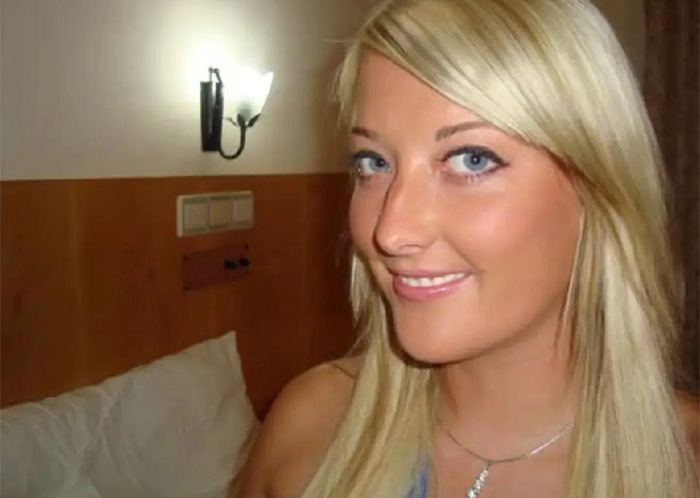 &ldquo;My Face Is Changing Every Day!&rdquo;: Woman’s $4k ‘Turkey Teeth’ Procedure Goes Horribly Wrong