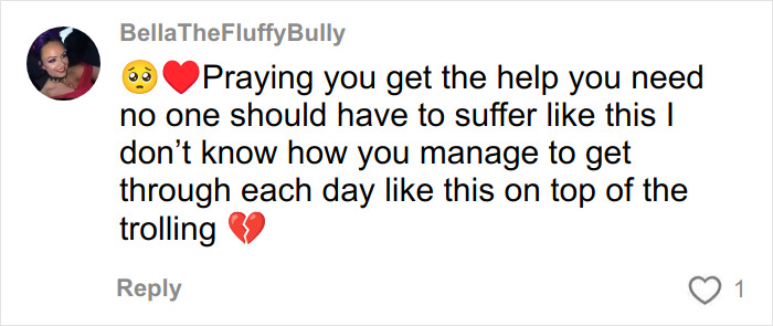 &ldquo;My Face Is Changing Every Day!&rdquo;: Woman’s $4k ‘Turkey Teeth’ Procedure Goes Horribly Wrong