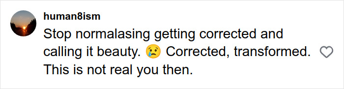 Britanny Snow Has Blunt Response To Plastic Surgery Rumors, But Netizens Say “Noses Don’t Lie” Britanny Snow Has Blunt Response To Plastic Surgery Rumors, But Netizens Say “Noses Don’t Lie”