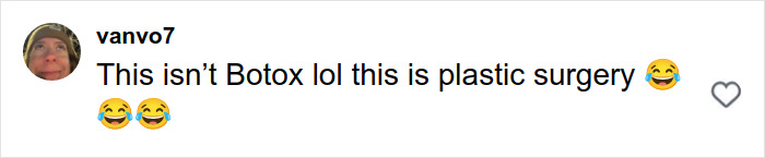 Britanny Snow Has Blunt Response To Plastic Surgery Rumors, But Netizens Say “Noses Don’t Lie” Britanny Snow Has Blunt Response To Plastic Surgery Rumors, But Netizens Say “Noses Don’t Lie”