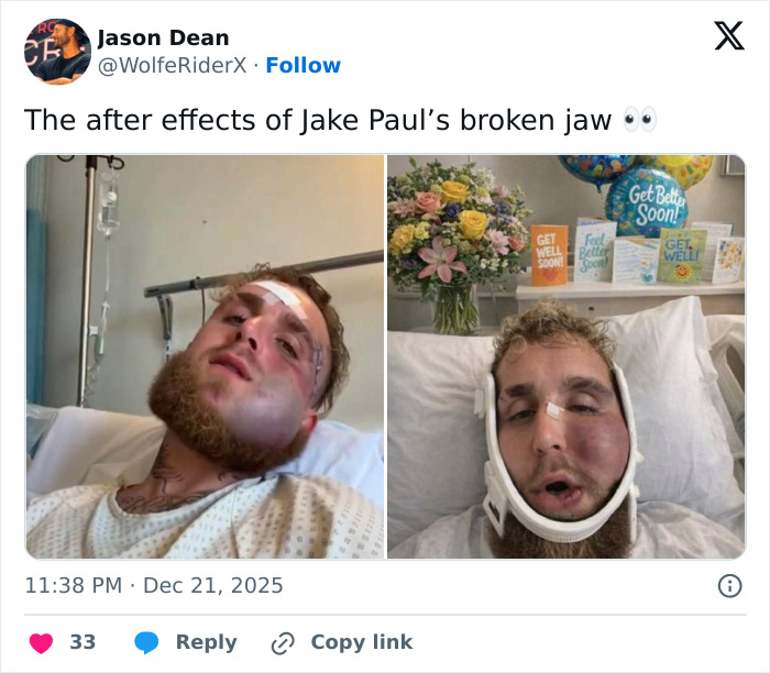 “Poetic Justice”: Jake Paul’s Broken Jaw Has Become The Internet’s Latest Punchline