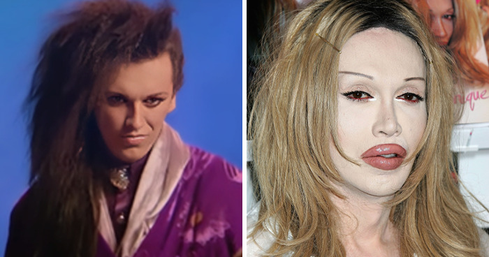 20 Celebrities Who Learned The Hard Way About Plastic Surgery