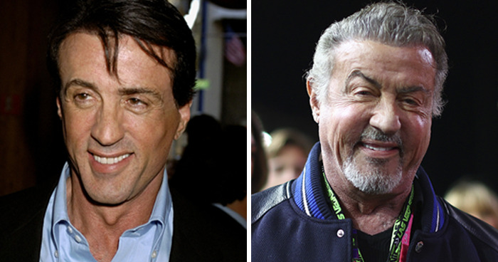 20 Celebrities Who Learned The Hard Way About Plastic Surgery