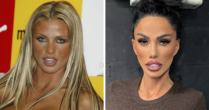 20 Celebrities Who Learned The Hard Way About Plastic Surgery