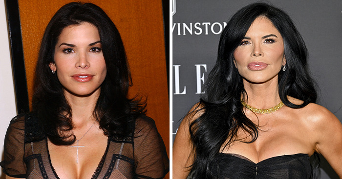 20 Celebrities Who Learned The Hard Way About Plastic Surgery