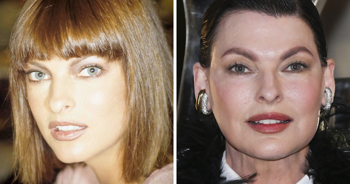 20 Celebrities Who Learned The Hard Way About Plastic Surgery