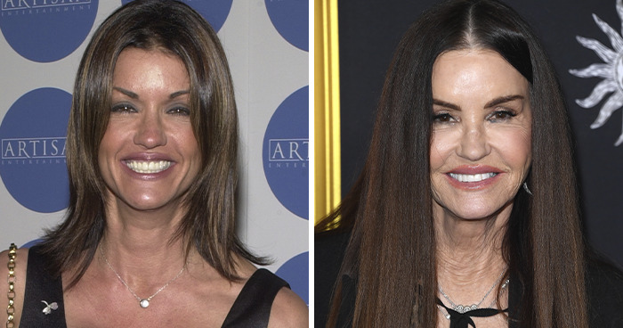 20 Celebrities Who Learned The Hard Way About Plastic Surgery