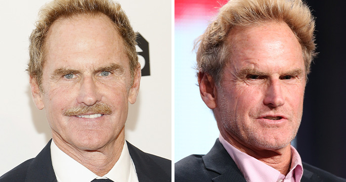 20 Celebrities Who Learned The Hard Way About Plastic Surgery